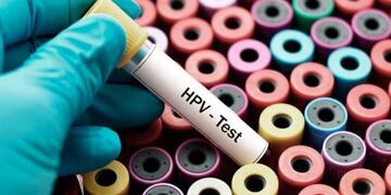 El HPV causa numerosas enfermedades.