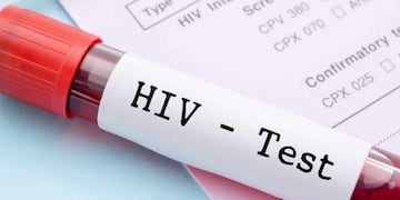 Una oportunidad de tomar conciencia sobre el VIH SIDA\u002E