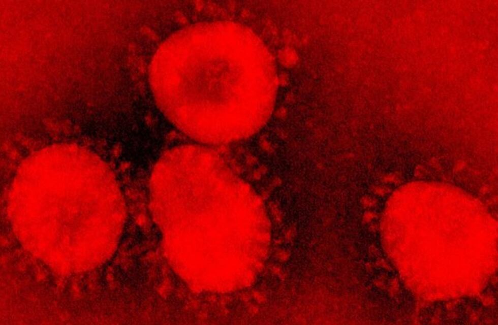 Confirman el caso número 13 de Coronavirus en Chaco