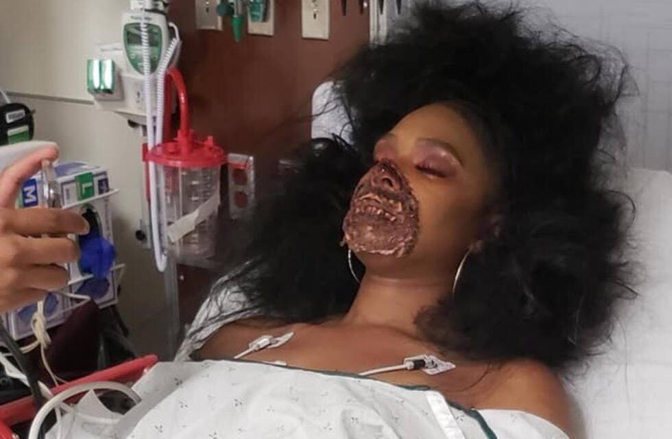 Fue al hospital y los médicos creyeron que las heridas de su maquillaje de zombie eran reales