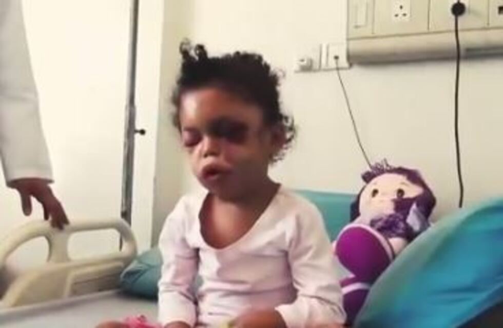 El desgarrador video de una nena de Yemén que perdió a toda su familia