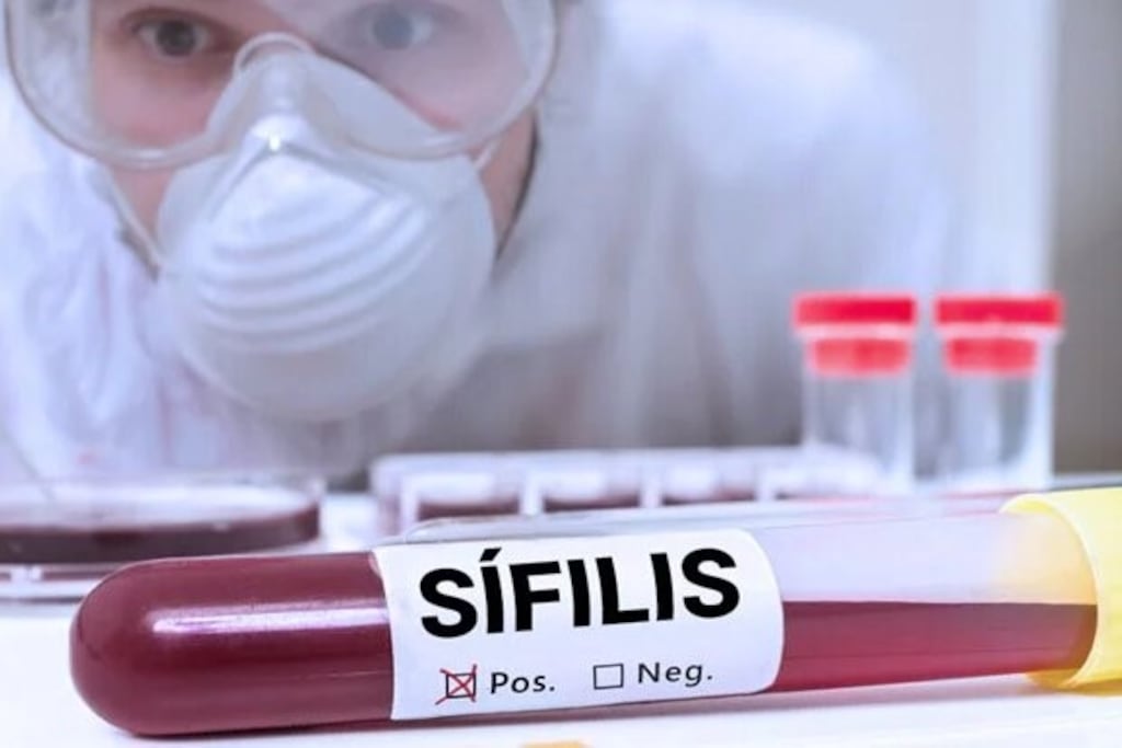 Los incrementos constantes y tan apresurados de sífilis pueden convertirse en un grave problema nacional en el mediano plazo (Web)\u002E