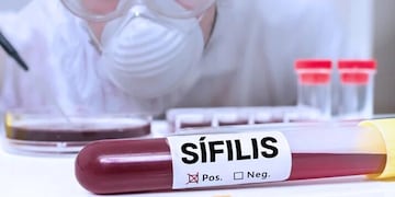 Los incrementos constantes y tan apresurados de sífilis pueden convertirse en un grave problema