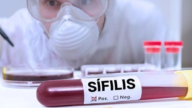 Los incrementos constantes y tan apresurados de sífilis pueden convertirse en un grave problema