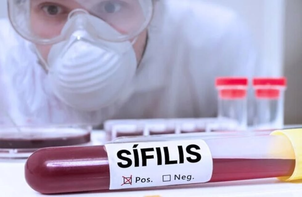 Aumentó la sífilis y la franja de edad afectada es de 15 a 25 años