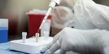 Un nuevo positivo y una nueva muerte por Covid-19 este miércoles en Córdoba\u002E