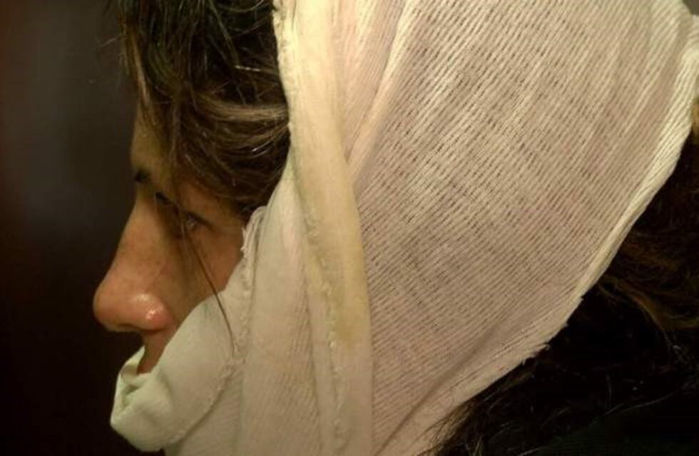 Bahía Blanca: roció con alcohol a su mujer y la prendió fuego