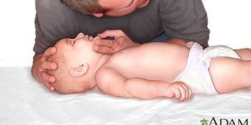 RCP BEBE