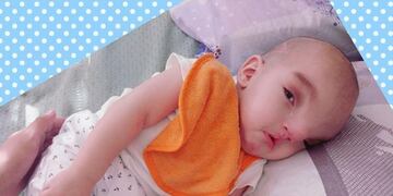 Ángel Amadeo evoluciona a todo pronóstico