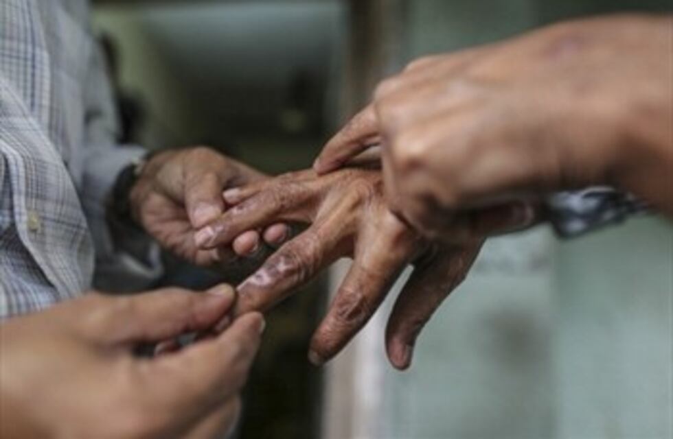 En el 2018 hubo 36 casos detectados de lepra en Misiones