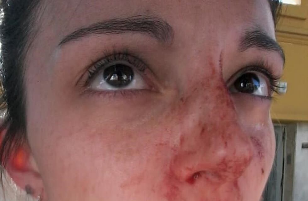 Una chica de 25 años subió el video en el que se ve a su ex golpeándola delante de su hijo