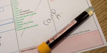 FILE PHOTO: A blood sample sits on a table at an antibody testing program at the Hollymoor Ambulance Hub of the West Midlands Ambulance Service, operated by the West Midlands Ambulance Service NHS Foundation Trust, in Birmingham, Britain June 5, 2020\u002E Simon Dawson/Pool via REUTERS/File Photo