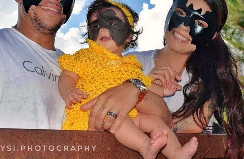 Operaron a Bati-nena, una bebé que nació con una extraña mancha en su rostro