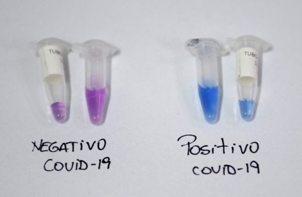 Tres nuevos casos de coronavirus en Santa Fe, todos de Rosario