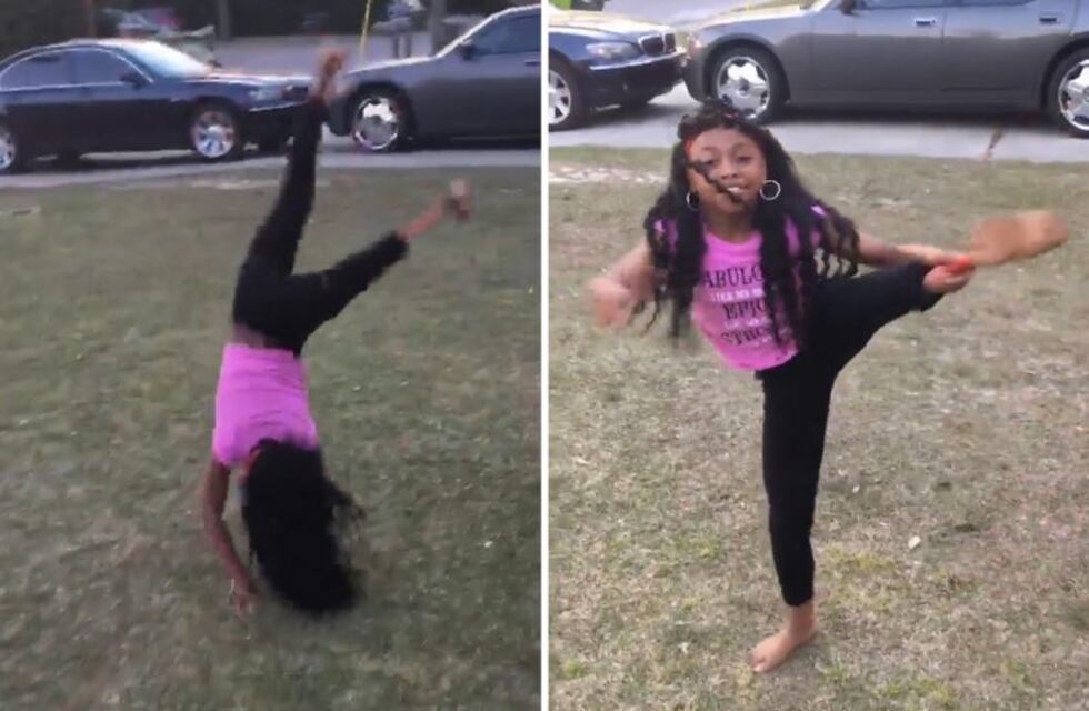 El increíble talento de una niña que hace acrobacias con una prótesis en una de sus piernas