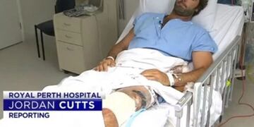 El surfer argentino que sobrevivió al ataque de un tiburón en Australia