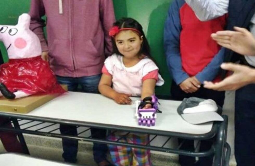 Su escuela le consiguió un prótesis 3D y ahora sueña con hacer música