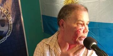 Tlemo Benitez, periodista de Tolhuin agredido salvajemente\u002E