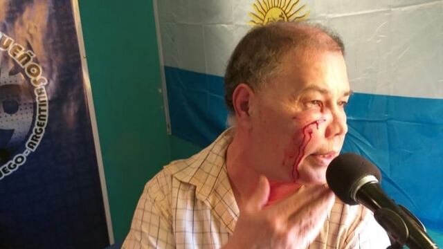 Tlemo Benitez, periodista de Tolhuin agredido salvajemente\u002E