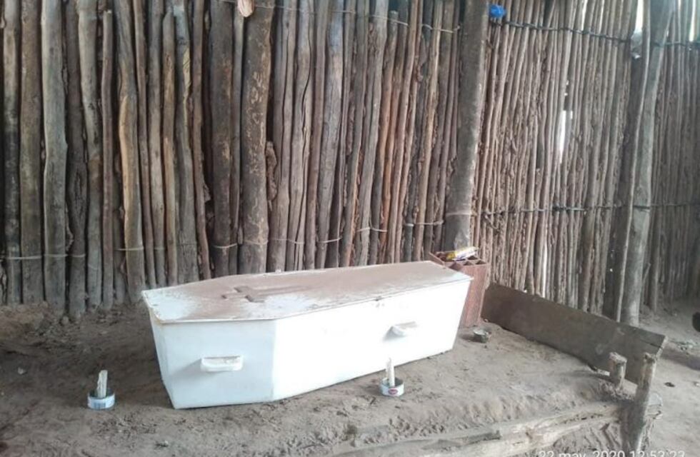 Murió otra niña wichí con antecedentes de desnutrición en Salta