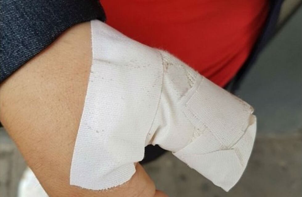 Para robarle el celular, le cortaron uno dedo