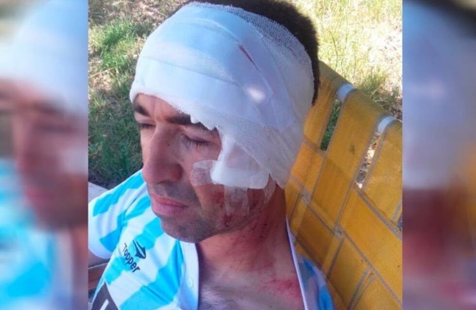 Quiso salvar a su taxi y por el viento Zonda una rama le partió la cabeza