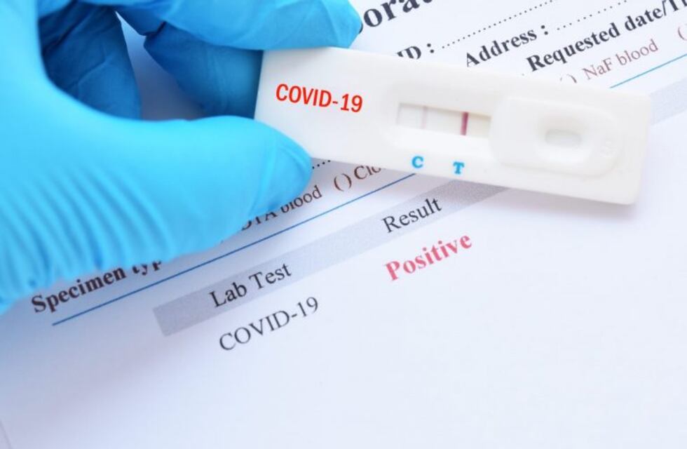 Una mujer de Jardín América arrojó positivo para Covid-19 en el ingreso a Corrientes