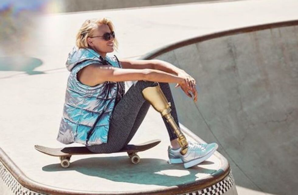 Es modelo y perdió una pierna por usar tampones