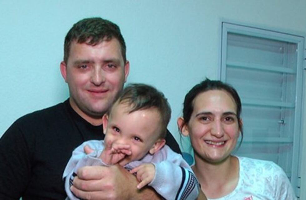 Renzo Oliva: recibió un nuevo implante de células madres