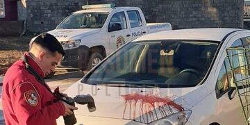 Derramaron liquido de frenos sobre el capot de un automovil