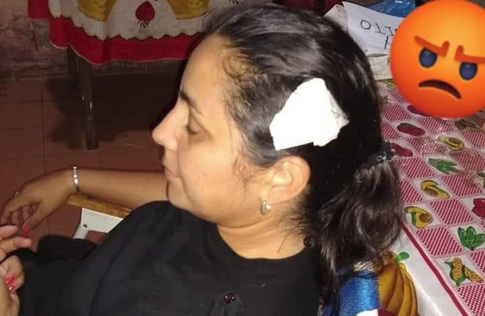 Una policía correntina denunció que fue brutalmente golpeada a la salida de un boliche