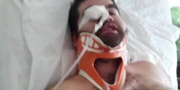 ataque en montecarlo