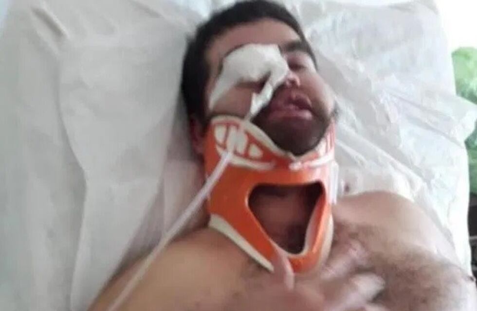 Montecarlo: investigan un ataque con armas de fuego a dos hombres oriundos de Colonia Delicia