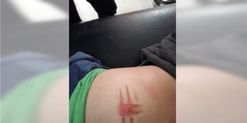 acoso escolar bullying