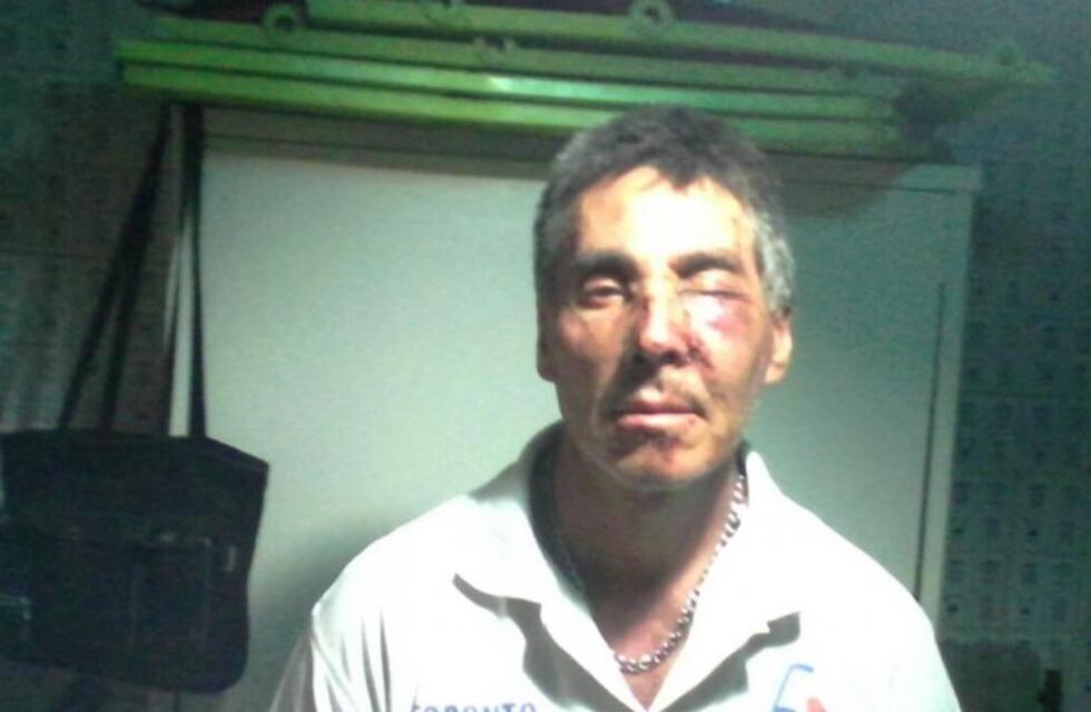 No pagó el estacionamiento medido en la puerta de su casa y le pegaron