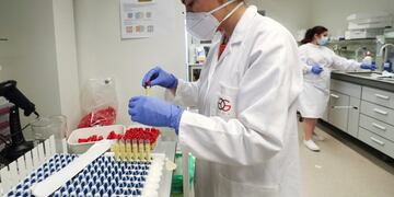 A laboratory worker checks PCR tests for the coronavirus disease (COVID-19) at the University of Liege, Belgium August 12, 2020\u002E According to the university, the test allows thousands of additional tests to be performed every day\u002E Picture taken August 12, 2020\u002E REUTERS/Yves Herman