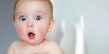 Nació con una mancha de nacimiento en la frente con forma de corazón y se volvió viral