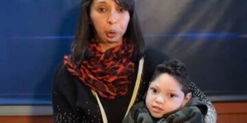Bautista tiene 3 años y padece de parálisis cerebral en Nicolás Bruzone, Córdoba\u002E