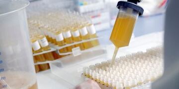 El gobierno nacional destinará esa suma para uso exclusivo del sector de la salud en Mendoza\u002E