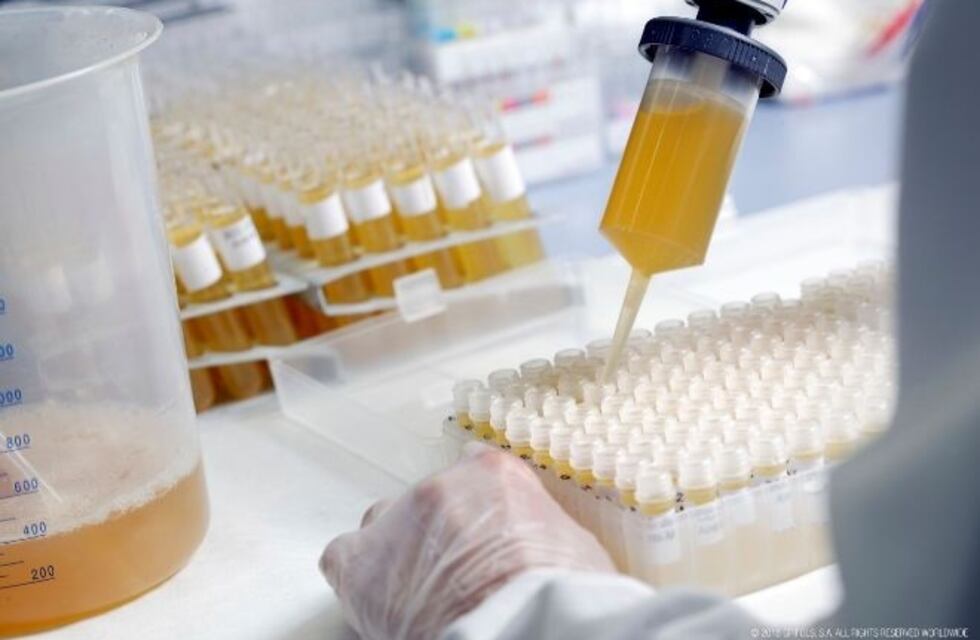 Mendoza recibirá $800 millones de Nación para enfrentar la pandemia