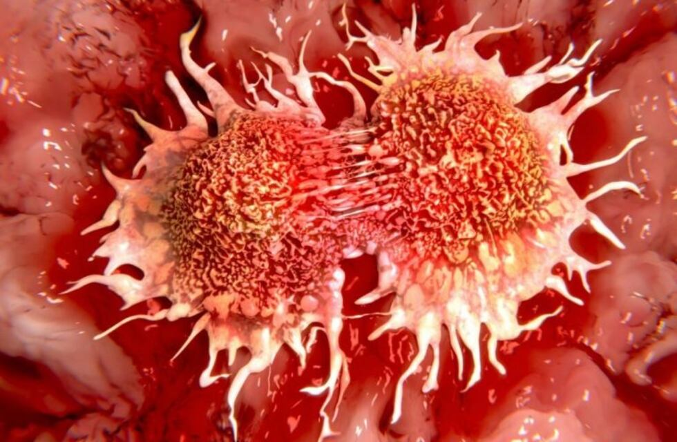 Cáncer: informarse en Carlos Paz