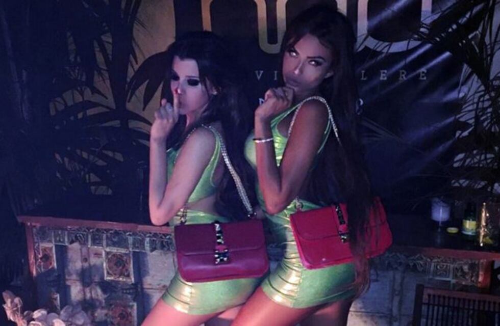 La amiga de Charlotte Caniggia se mostró tras casi perder las piernas en un atentado