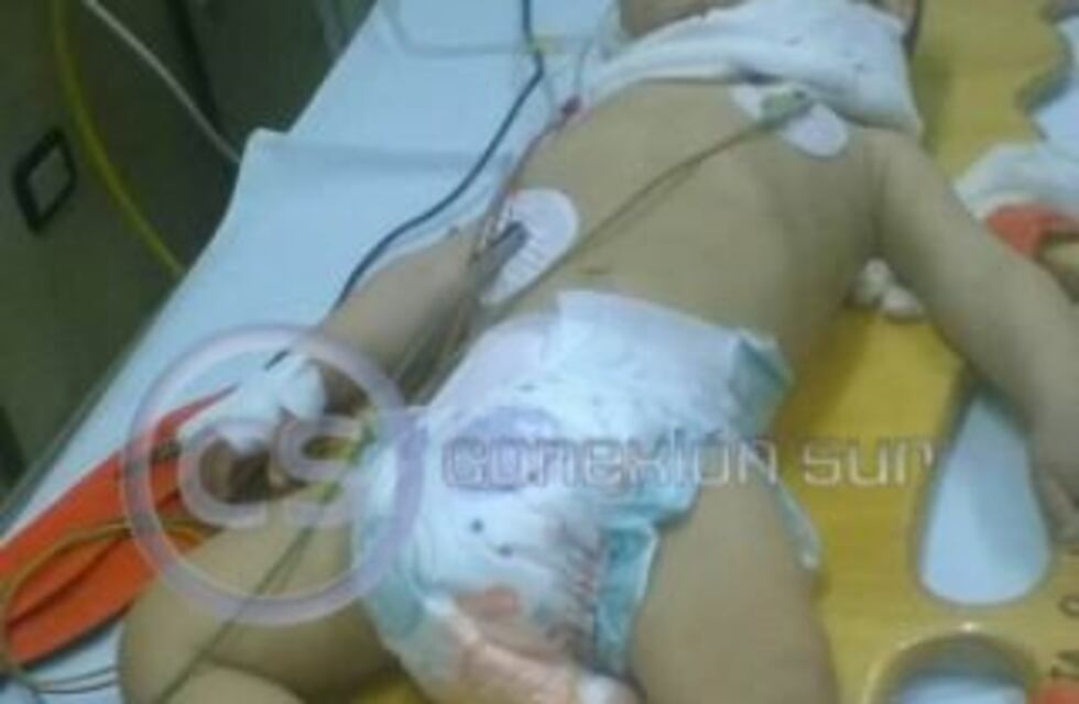 Detuvieron a una pareja que emborrachó y le fracturó el cráneo a su bebé en Florencio Varela