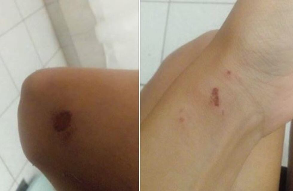 Fue asaltada por motochorros que la golpearon y arrastaron para llevarle la cartera