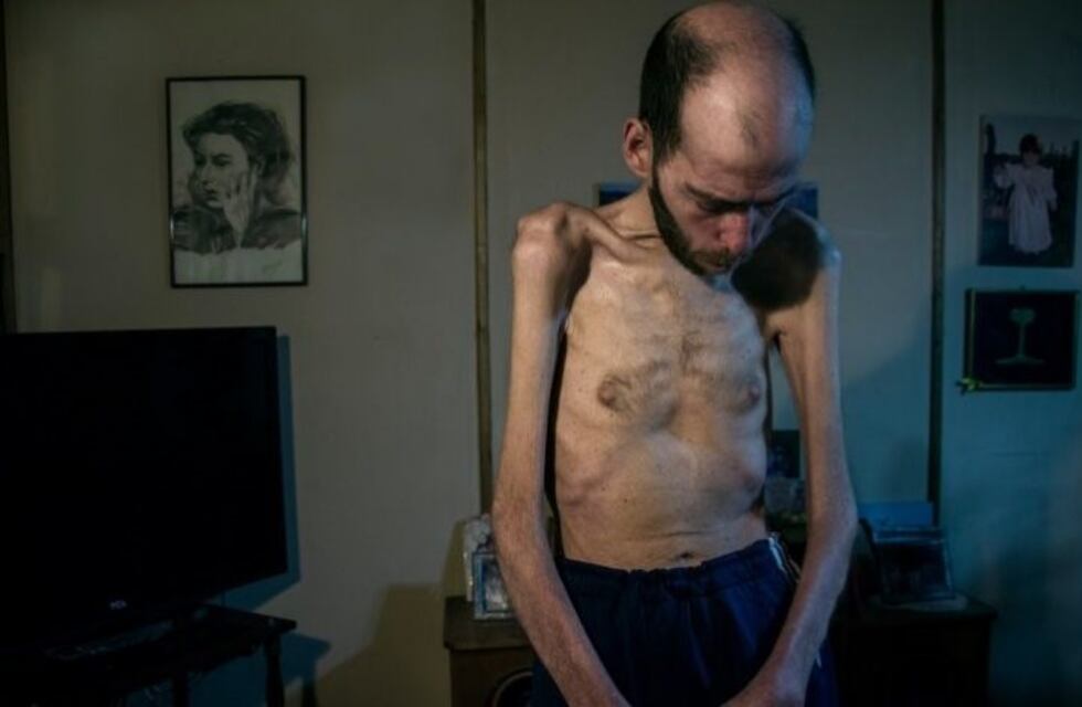 Murió Fabián Tomasi, víctima del glifosato