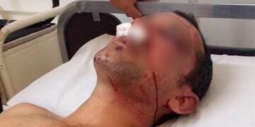 Agresión en Basavilbaso Entre Ríos\nCrédito: FMRiel