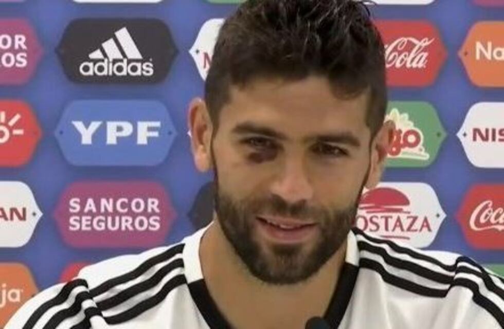 Fazio bromeó con su ojo morado: "Pavón está haciendo mucho quilombo"