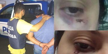 Villa María. Así quedó el rostro de una de las mujeres víctima de violencia de género. (Villa María Ya)