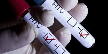 HIV