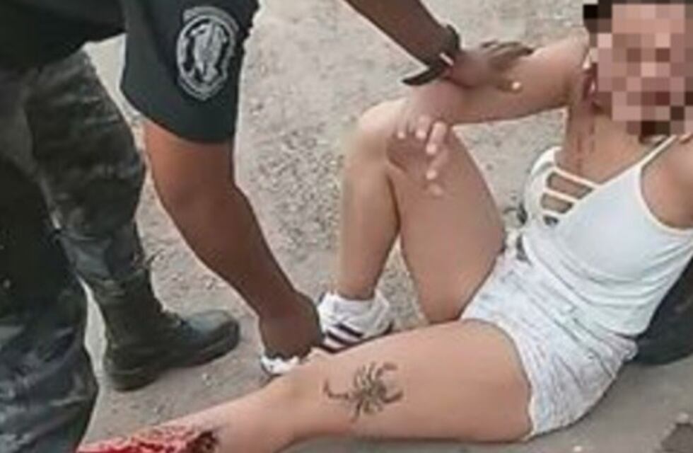 Polémica por el escopetazo y accionar policial contra una asaltante en General Alvear